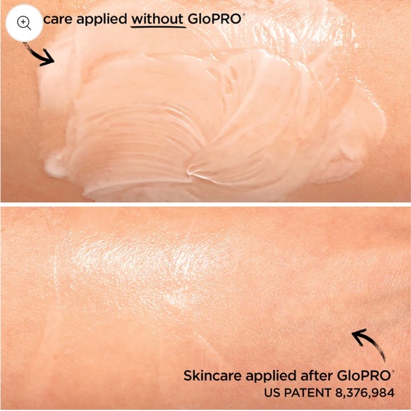 GLOPRO Facial Microneedling Tool - Picture 3 of 10